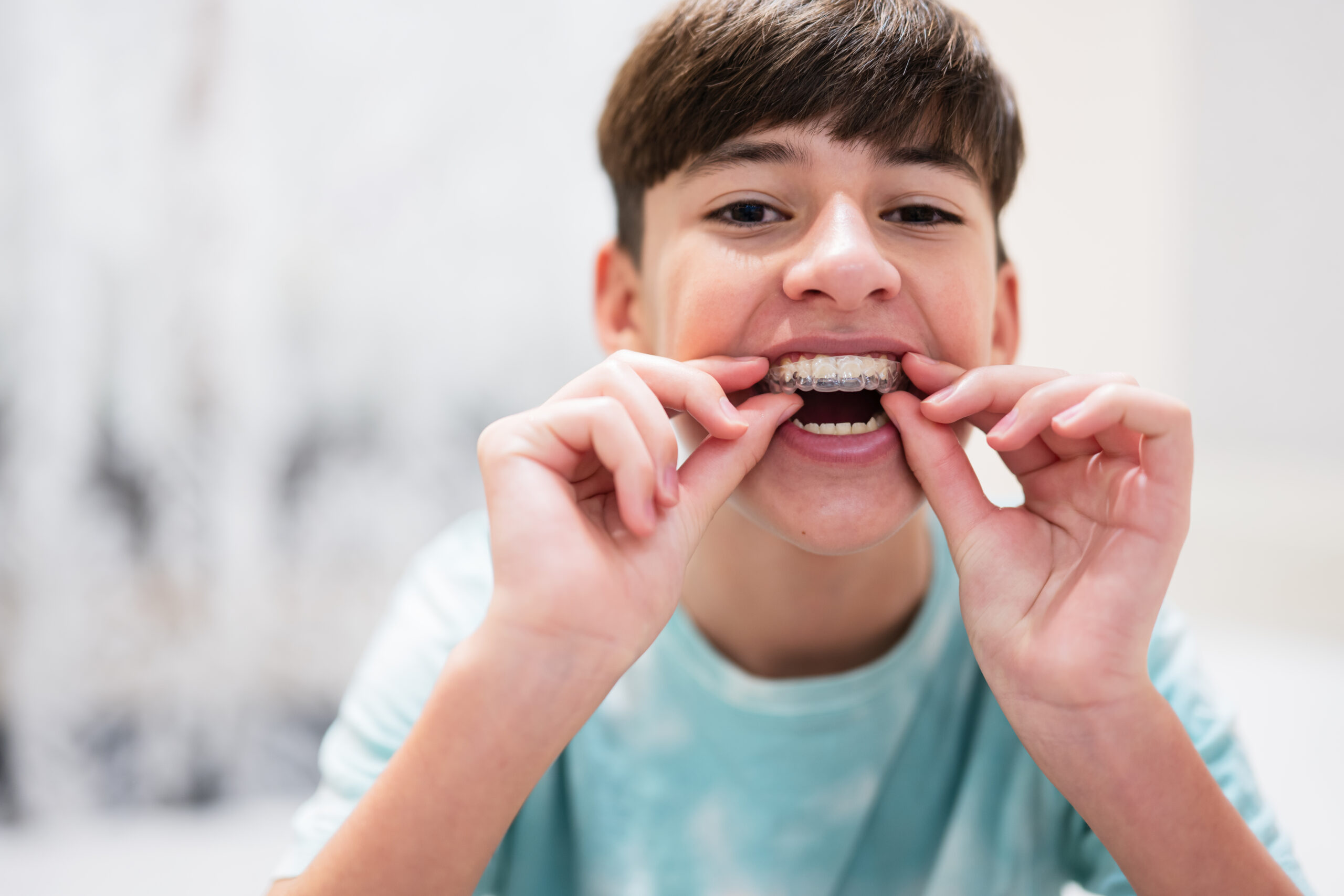¿Cuáles son los diferentes sistemas de ortodoncia que existen?