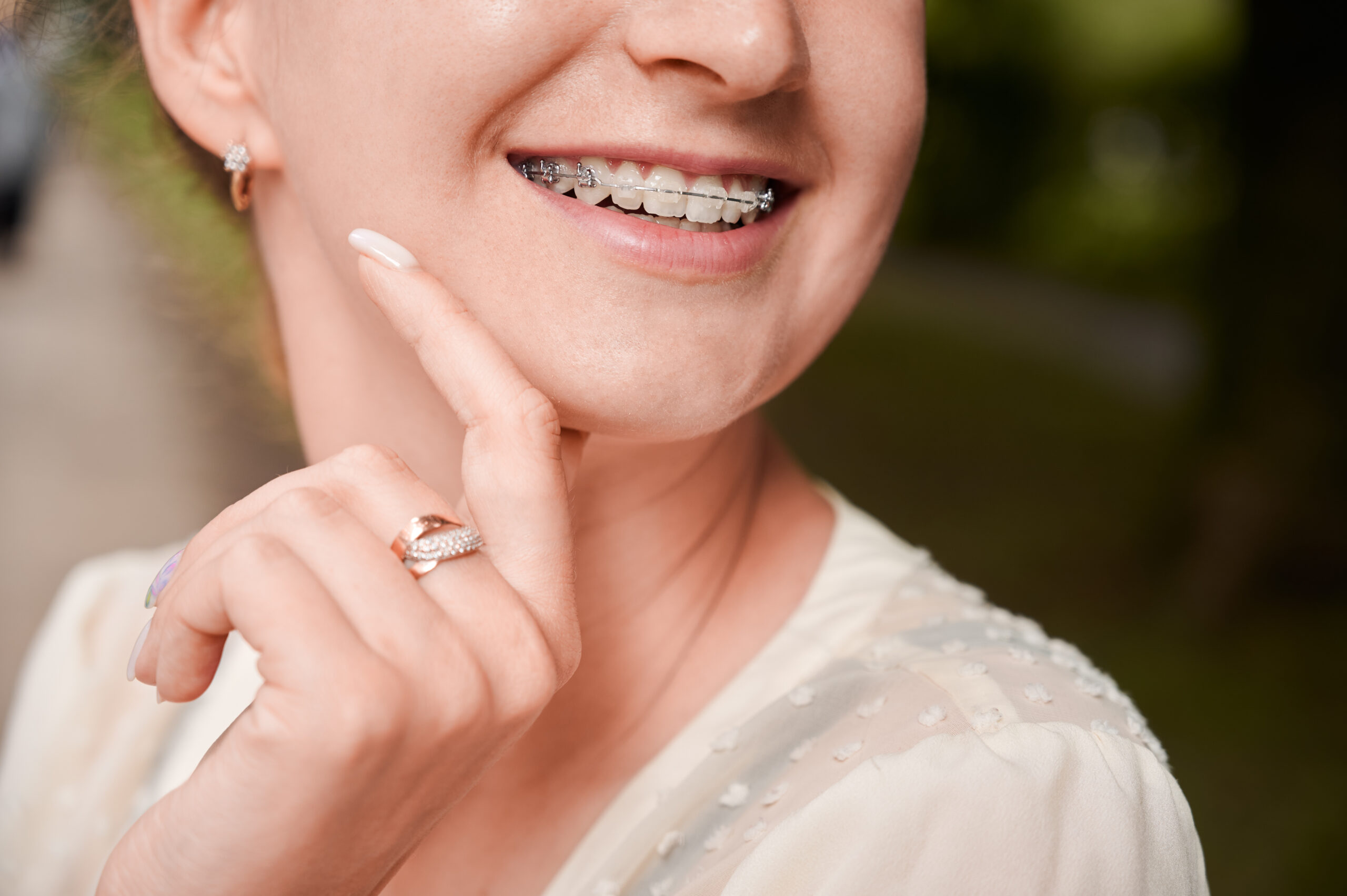 ¿Por qué es importante realizar un tratamiento de ortodoncia?